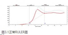 潤滑油檢測中抗氧化劑含量(RULER)是什么？